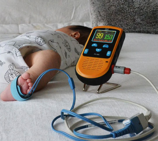 اجاره پالس اکسیمتر نوزاد 