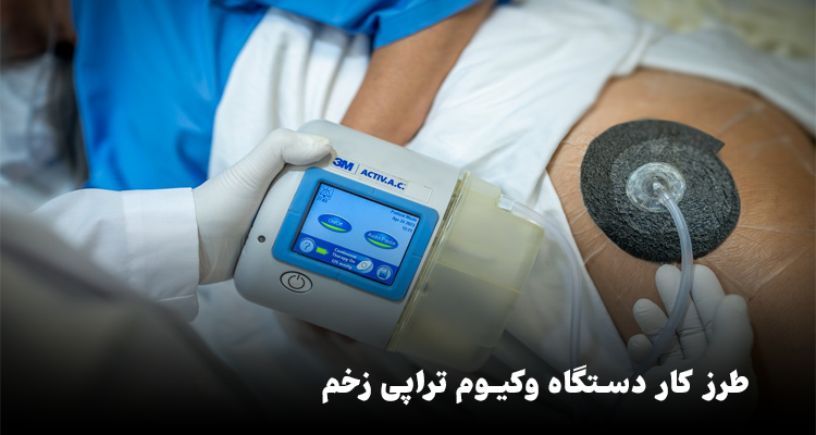 طرز کار دستگاه وکیوم تراپی زخم