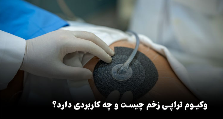 وکیوم تراپی زخم چیست و چه کاربردی دارد؟