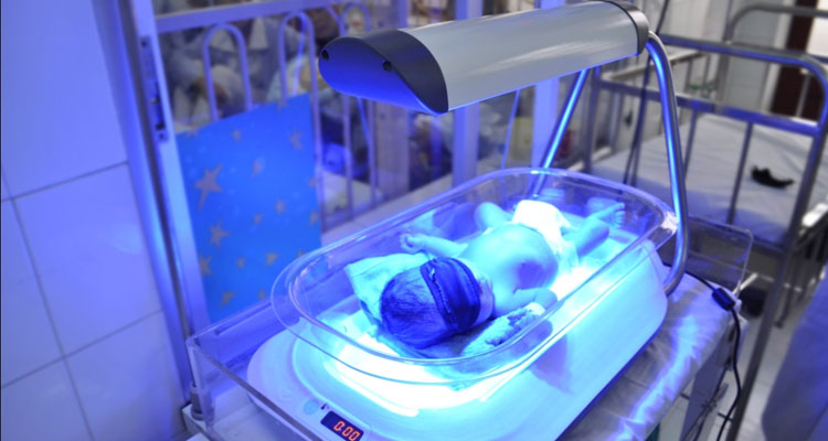 عوارض نور دستگاه زردی برای اطرافیان